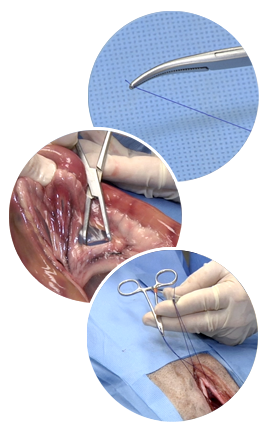 three images of surgical clamps