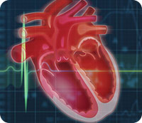Cross section of a heart